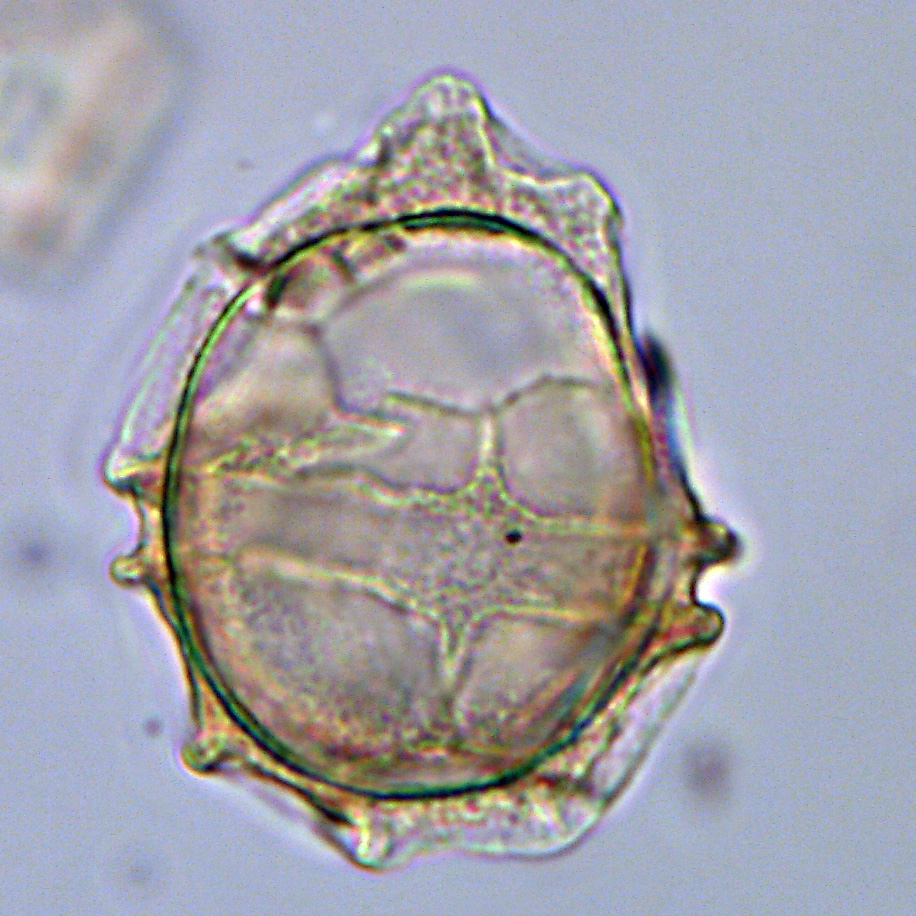 Phthanoperidinium sp., 1408C-16H-5W, 21-22, sl. 1, N23, foto-c.jpg